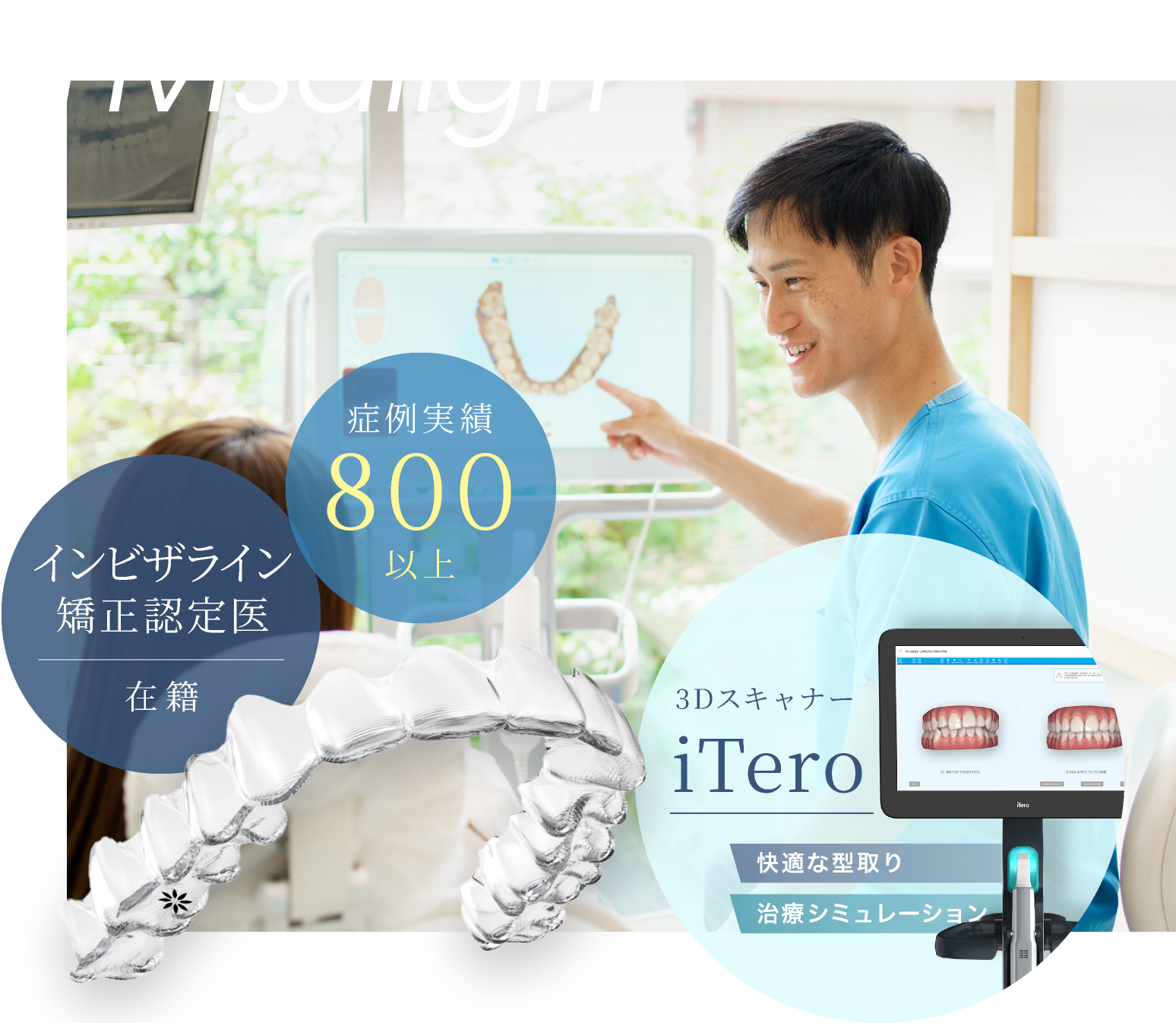 インビザライン